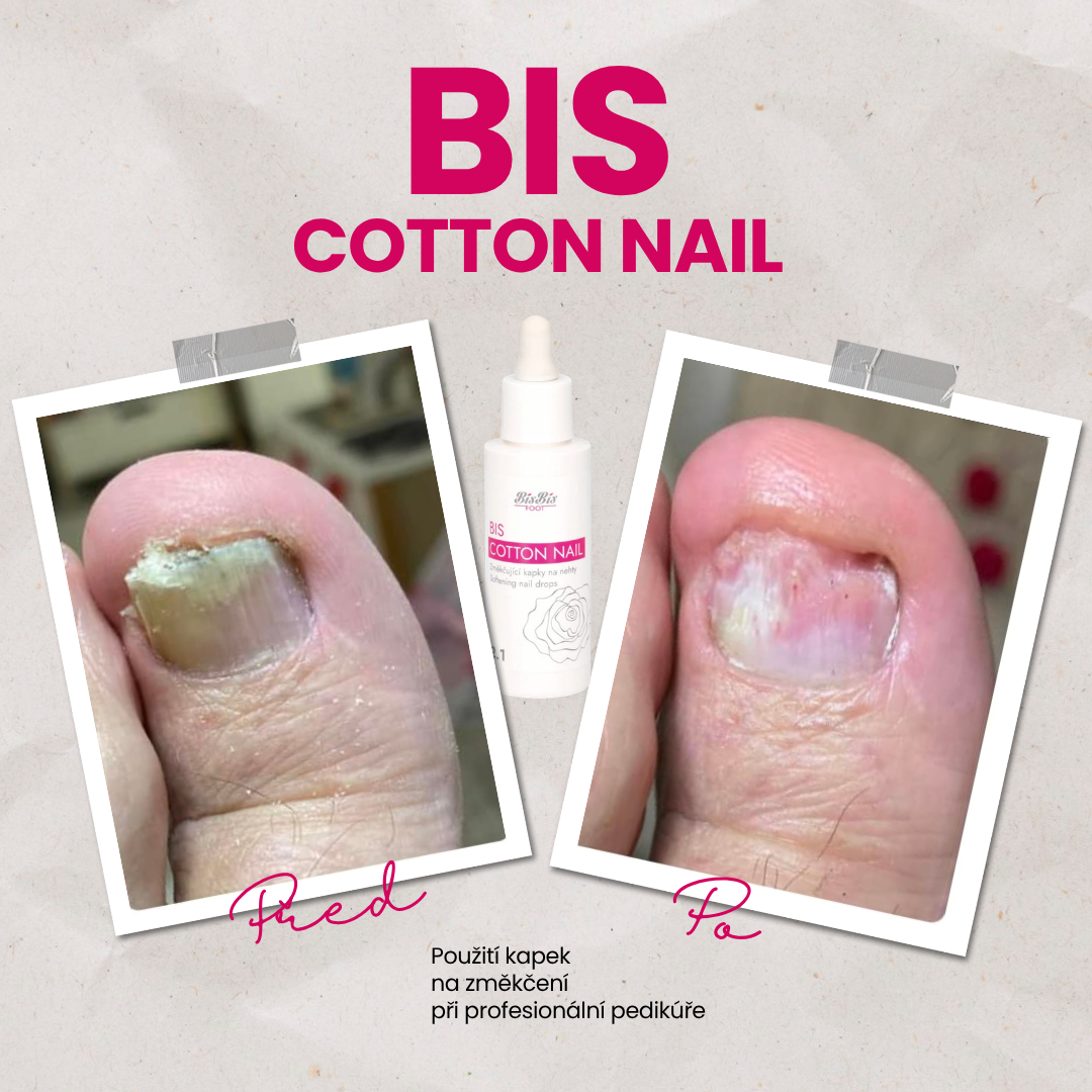 cotton nail kapky